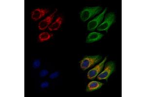 ABIN7094748 and ABIN7098799 staining Hela cells by IF/ICC. (DHCR7 抗体  (N-Term))