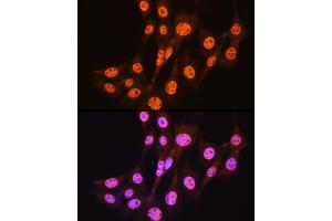 Immunofluorescence analysis of NIH-3T3 cells using [KO Validated] Smad3 Rabbit mAb (ABIN7270349) at dilution of 1:100 (40x lens). (SMAD3 抗体)