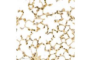 Immunohistochemistry of paraffin embedded mouse pneumonia using MNDA (ABIN7074709) at dilution of 1:2000 (400x lens) (MNDA 抗体)