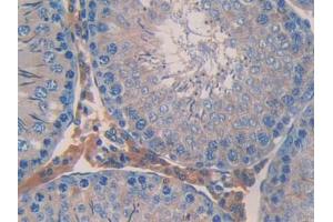 Used in DAB staining on fromalin fixed paraffin- embedded stomach tissue (ANGPTL2 抗体  (AA 47-207))