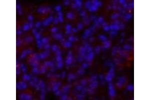 Immunofluorescence analysis of Rat lung tissue using GLUT-1 Polyclonal Antibody at dilution of 1:200. (GLUT1 抗体)