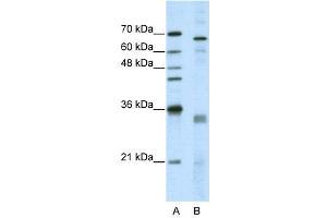 WB Suggested Anti-SFRS1  Antibody Titration: 5.