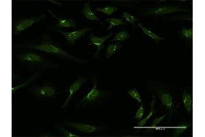 Immunofluorescence of purified MaxPab antibody to GOLGA1 on HeLa cell. (GOLGA1 抗体  (AA 1-767))