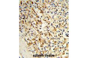 Formalin-fixed and paraffin-embedded human spleen tissue reacted with PCAT1 Antibody (C-term), which was peroxidase-conjugated to the secondary antibody, followed by DAB staining. (LPCAT1 抗体  (C-Term))