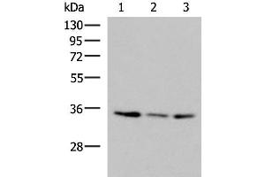 Western blot analysis of HepG2 HL60 cell Human fetal liver tissue lysates using ISY1-RAB43 Polyclonal Antibody at dilution of 1:1000 (ISY1-RAB43 Readthrough (ISY1-RAB43) 抗体)