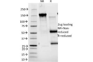 SDS-PAGE Analysis Purified CD25 Mouse Monoclonal Antibody (143-13). (CD25 抗体)