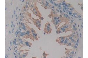 Detection of HIF1aN in Human Prostate Tissue using Polyclonal Antibody to Hypoxia Inducible Factor 1 Alpha Subunit Inhibitor (HIF1aN)