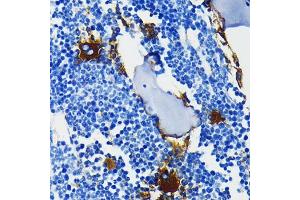 Immunohistochemistry of paraffin-embedded mouse bone marrow using Integrin beta 3 (ITGB3/CD61) (ITGB3/CD61) Rabbit mAb (ABIN7267928) at dilution of 1:100 (40x lens). (Integrin beta 3 抗体)