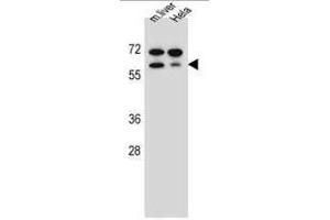TBX6 Antibody (Center W158) western blot analysis in mouse liver tissue and Hela cell line lysates (35µg/lane). (T-Box 6 抗体  (Middle Region))