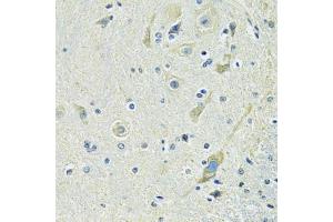 Immunohistochemistry of paraffin-embedded mouse spinal cord using SLC1A4 antibody (ABIN6292419) at dilution of 1:100 (40x lens). (SLC1A4 抗体)
