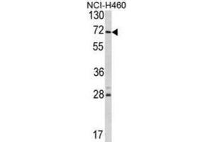 Western Blotting (WB) image for anti-Ubiquitin Specific Peptidase 21 (USP21) antibody (ABIN3001425) (USP21 抗体)