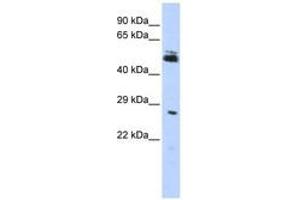 Image no. 1 for anti-Ring Finger Protein 212 (RNF212) (AA 72-121) antibody (ABIN6740828) (RNF212 抗体  (AA 72-121))