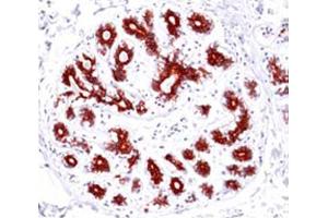 Immunohistochemistry (IHC) image for anti-BCL2-Associated X Protein (BAX) (Internal Region) antibody (ABIN6655295)