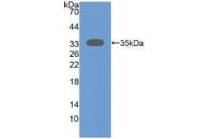 Western blot analysis of recombinant Human SIRT2. (SIRT2 抗体  (AA 65-340))