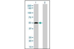 Western Blotting (WB) image for anti-Acid Phosphatase 2, Lysosomal (ACP2) antibody (ABIN781949)