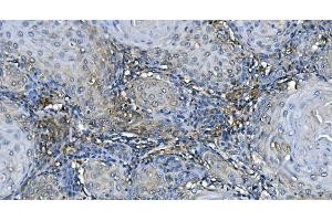 IHC analysis of GABARAP using anti-GABARAP antibody (ABIN7603159). (GABARAP 抗体  (N-Term))