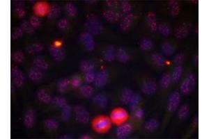 Immunofluorescence staining of methanol-fixed HeLa cells using ELK1 (phospho T417) polyclonal antibody . (ELK1 抗体  (pThr417))