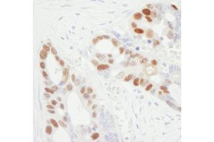 Immunohistochemistry (IHC) image for anti-Minichromosome Maintenance Complex Component 6 (MCM6) (C-Term) antibody (ABIN7449392)