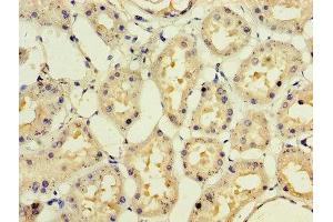 Immunohistochemistry of paraffin-embedded human kidney tissue using ABIN7141980 at dilution of 1:100 (IFNA1 抗体  (AA 24-189))