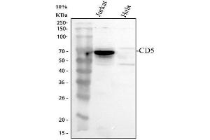 Western blot analysis of CD5 using anti-CD5 antibody (ABIN5693203). (CD5 抗体  (AA 25-495))