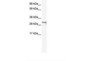 Image no. 1 for anti-Short Stature Homeobox 2 (SHOX2) (AA 180-229) antibody (ABIN6735956) (SHOX2 抗体  (AA 180-229))