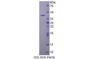 SDS-PAGE analysis of Mouse AADAT Protein. (AADAT 蛋白)