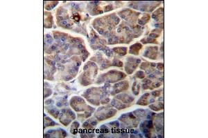 SNX29 Antibody (C-term) (ABIN657262 and ABIN2846357) immunohistochemistry analysis in formalin fixed and paraffin embedded human pancreas tissue followed by peroxidase conjugation of the secondary antibody and DAB staining. (SNX29 抗体  (C-Term))