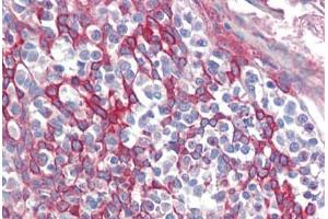Immunohistochemistry (Paraffin-embedded Sections) (IHC (p)) image for anti-Tripartite Motif Containing 8 (TRIM8) (AA 36-85) antibody (ABIN6741584)