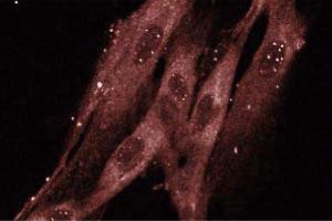 Immunofluorescence staining of WI-38 cells (human lung fibroblasts, ATCC CCL-75). (RAB8A 抗体  (AA 84-205))