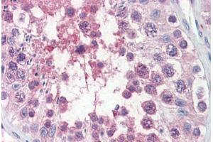 Human Testis (formalin-fixed, paraffin-embedded) stained with TRIM8 antibody ABIN462222 followed by biotinylated goat anti-rabbit IgG secondary antibody ABIN481713, alkaline phosphatase-streptavidin and chromogen. (TRIM8 抗体  (AA 36-85))