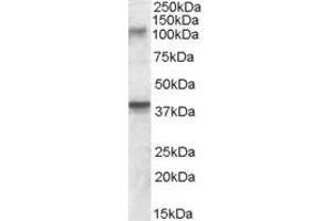 Western Blotting (WB) image for anti-Glutamate Receptor, Ionotropic, Kainate 3 (GRIK3) (AA 203-216) antibody (ABIN343069) (GRIK3 抗体  (AA 203-216))
