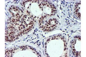 Image no. 8 for anti-Ubiquitin Specific Peptidase 7 (Herpes Virus-Associated) (USP7) antibody (ABIN1498592) (USP7 抗体)