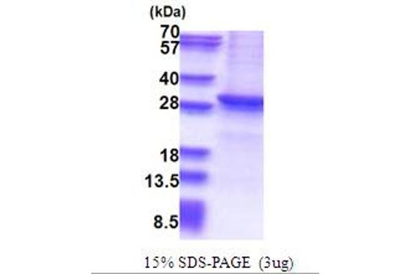 SIRT1 Protein (AA 254-495) (His tag)