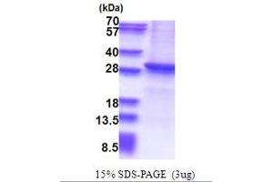 SDS-PAGE (SDS) image for Sirtuin 1 (SIRT1) (AA 254-495) protein (His tag) (ABIN5853631) (SIRT1 Protein (AA 254-495) (His tag))