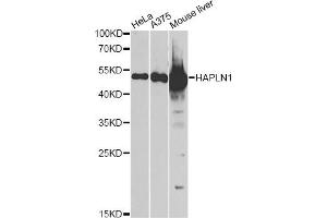 Western blot analysis of extracts of various cell lines, using HAPLN1 antibody. (HAPLN1 抗体)
