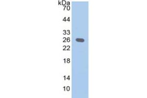 WB of Protein Standard: different control antibodies against Highly purified E. (EBI3 CLIA Kit)