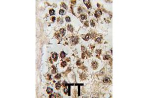 Formalin-fixed and paraffin-embedded human testis tissue reacted with MLLT10 polyclonal antibody  , which was peroxidase-conjugated to the secondary antibody, followed by DAB staining. (MLLT10 抗体  (C-Term))