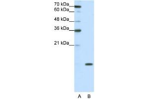 WB Suggested Anti-SNRPD1 Antibody Titration:  0. (SNRPD1 抗体  (N-Term))