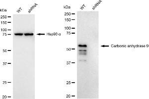 Western blotting analysis using Carbonic anhydrase 9 antibody (ABIN7797869). (Recombinant CA9 抗体)