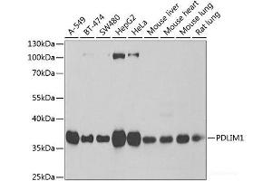 Western blot analysis of extracts of various cell lines using PDLIM1 Polyclonal Antibody at dilution of 1:1000. (PDLIM1 抗体)