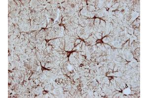 Immunohistochemistry (Paraffin-embedded Sections) (IHC (p)) image for anti-Glial Fibrillary Acidic Protein (GFAP) antibody (ABIN1742363)