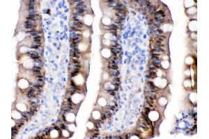 FABP2/I-FABP was detected in paraffin-embedded sections of rat intestine tissues using rabbit anti- FABP2/I-FABP Antigen Affinity purified polyclonal antibody (Catalog # ) at 1 µg/mL.