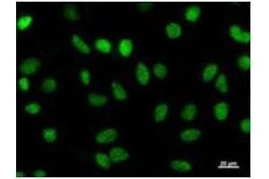 Immunostaining analysis in HeLa cells. (HEXIM1 抗体)