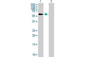 Western Blot analysis of FRMD8 expression in transfected 293T cell line by FRMD8 MaxPab polyclonal antibody. (FRMD8 抗体  (AA 1-464))