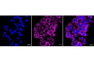 Immunocytochemical staining of HepG2 cells with Sphingosine-1-phosphate receptor 1 antibody (ABIN7800422), 1:1,000). (Recombinant S1PR1 抗体)