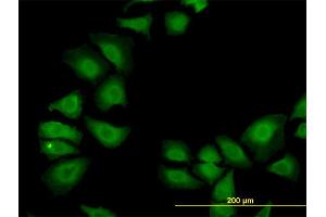 Immunofluorescence of monoclonal antibody to TXN on HeLa cell. (TXN 抗体  (AA 1-105))