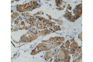 IHC-P analysis of rectum tissue, with DAB staining. (Plastin 3 抗体  (AA 234-475))