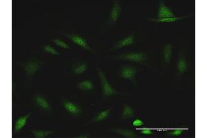 Immunofluorescence of purified MaxPab antibody to CCDC6 on HeLa cell. (CCDC6 抗体  (AA 1-474))