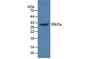 Detection of Recombinant MUC17, Human using Polyclonal Antibody to Mucin 17 (MUC17) (MUC17 抗体  (AA 3773-3998))