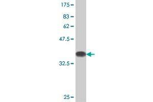 Western Blot detection against Immunogen (36. (UPF3A 抗体  (AA 382-475))